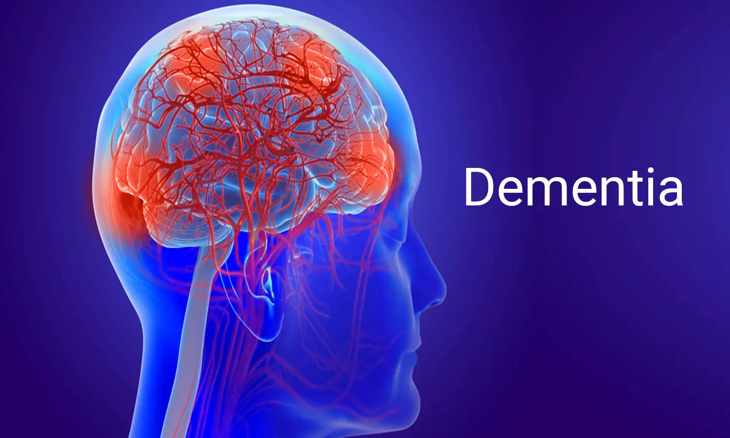 dementia feature image