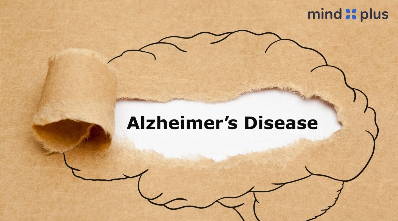 alzheimer's disease